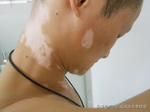 国庆旅游人挤人黄山图片,黄山旅游人挤人视频