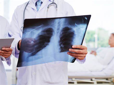 得了肺结核家人怎样预防,家长确诊肺结核对孩子有什么影响