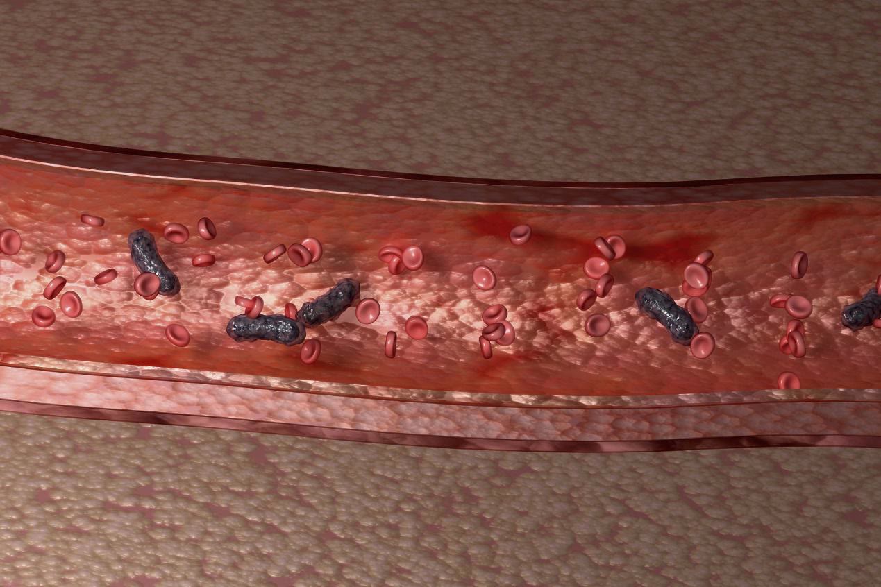 败血症和白血病的症状有什么区别,败血症与白血病有什么区别