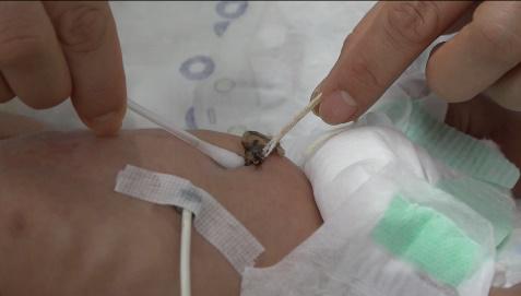 预防传染病的科普宣教,预防感染的科普小视频