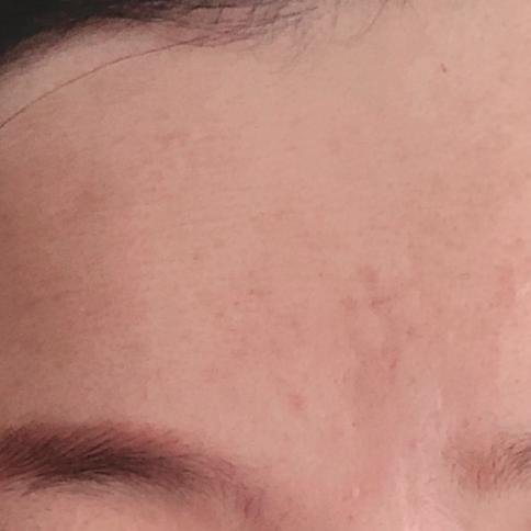 科颜氏抗初老精华露元气弹,科颜氏小白瓶跟元气弹