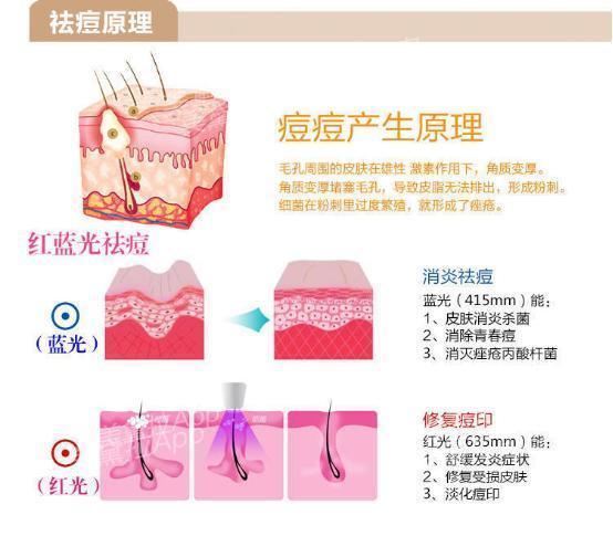 痘痘肌大作战视频教程,痘痘肌的修复