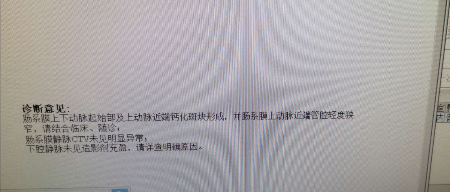 中西医结合治疗原因不明肠梗阻、腹水转氨酶明显升高病案一例！