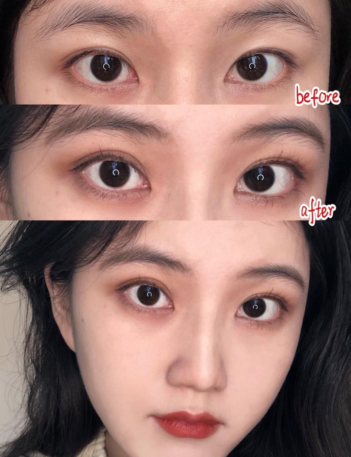 眼部消肿教程,眼部消肿最有效的方法