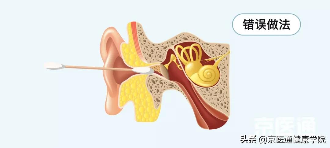 刷牙、剪指甲、滴眼药...这些生活技能很多人都做错了