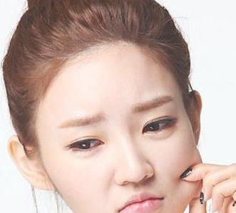 额头长又肿又痛的痘痘怎么办,额头长痘用什么才能缓解压力