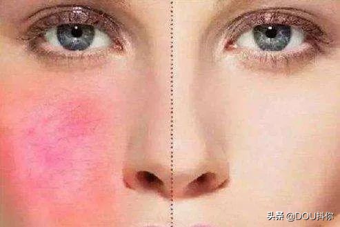 杨幂同款蒸脸器,杨幂代言的蒸脸器是什么牌子