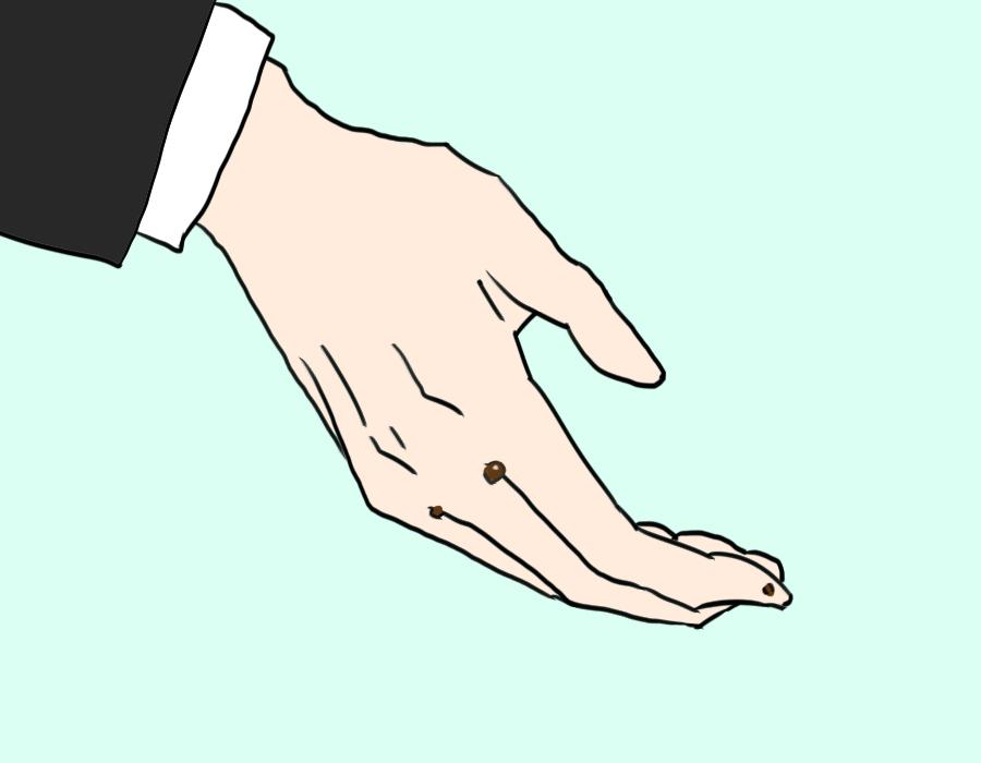 医声-有医招⑪|指甲突然变黑了？你可能得了这种病