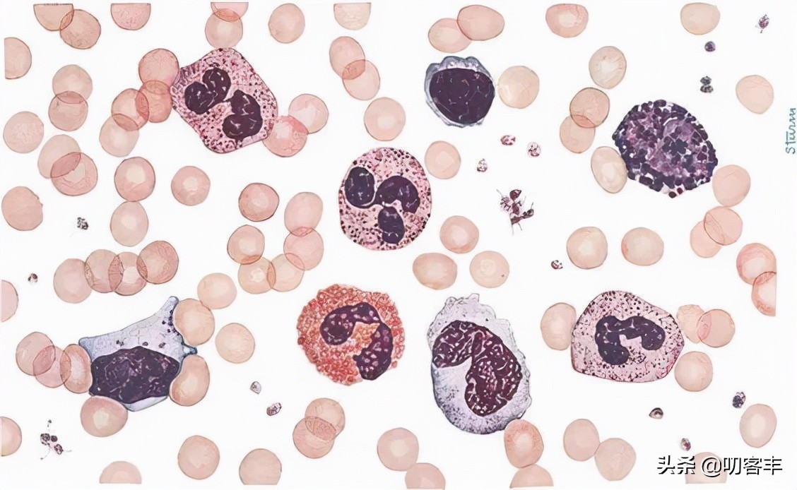 宝宝白细胞高细菌感染怎么治疗,细菌感染白细胞不高