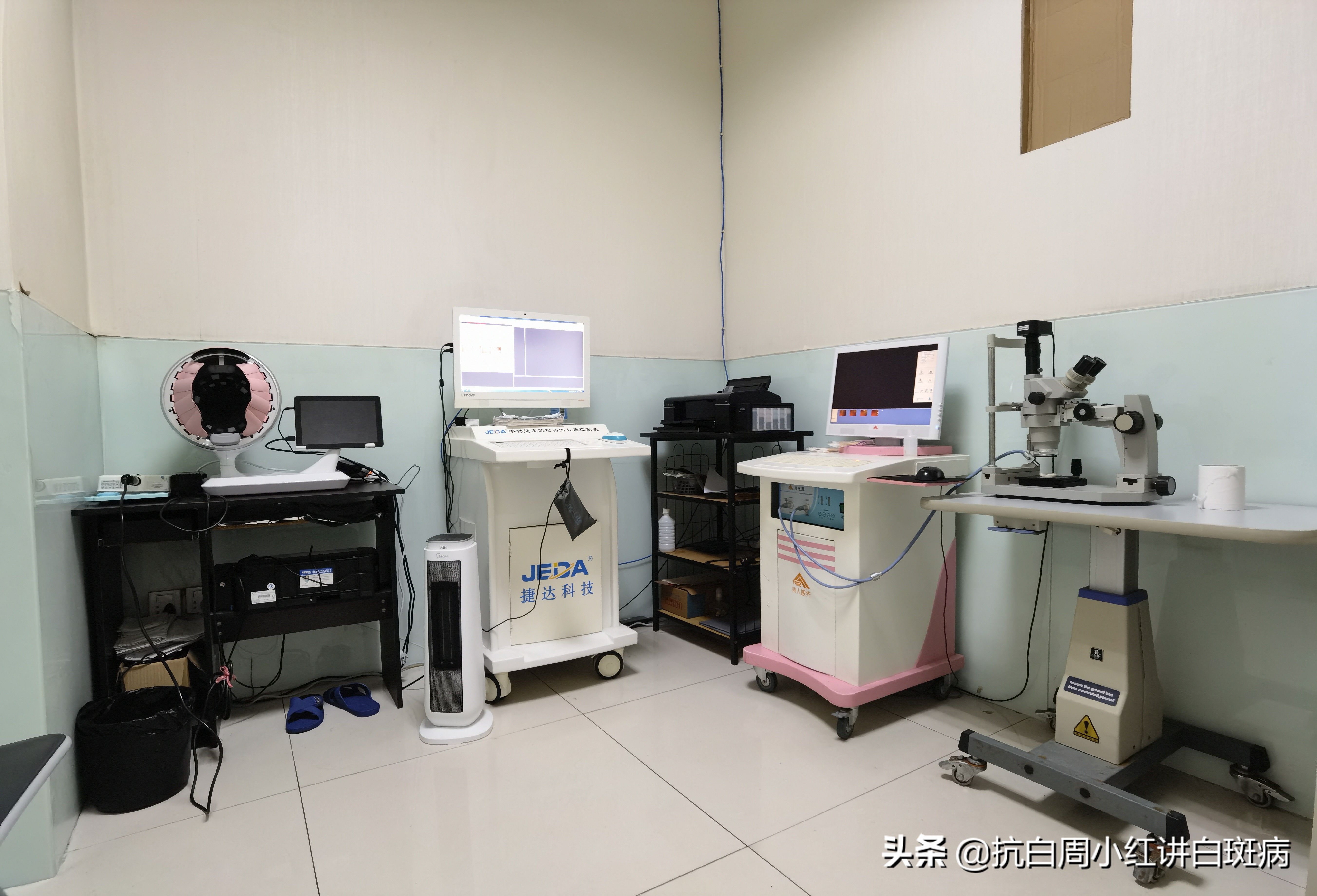 白癜风诊断标准无荧光是啥意思,白癜风早期如何治疗才有效