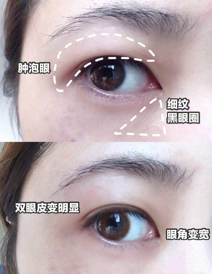 眼袋眼纹黑眼圈别慌试试这个方法,轻松解决眼纹眼袋黑眼圈