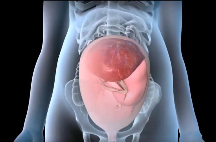 人造子宫实现让人类复活,人类能接受人造子宫吗