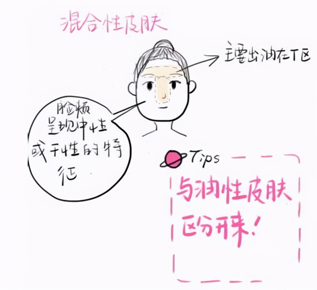 混合性肌肤t区出油怎么办,混合皮肤t区出油是什么原因