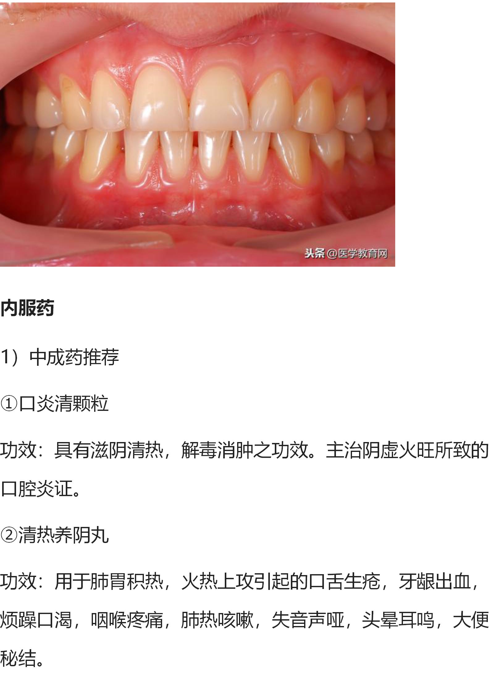 口腔牙龈最新治疗,口腔牙龈出血有什么好的方法