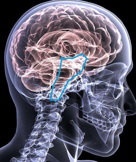 最凶险的脑干出血几毫升也要命,医生提醒:做好5点就能远离它