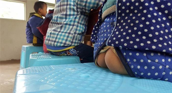 1岁男童“命根子”被扯掉一半，医生的话让家长后悔不已