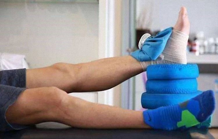 孩子撞伤淤青,小朋友撞淤青应热敷还是冷敷