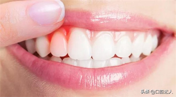 牙齿酸软无力是怎么了,牙齿咬不动就酸软无力