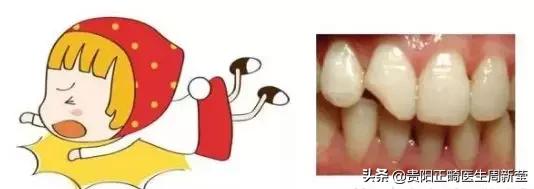牙疼淋巴肿大是什么原因引起的,牙疼白天不疼晚上疼是什么原因