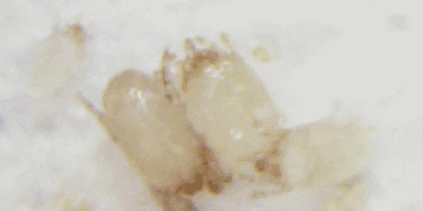 洗衣服≠洗干净，每晚百万只螨虫可能陪你和孩子一起睡