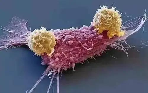 肺癌患者免疫治疗后胸闷气短,肺癌患者免疫治疗临床治愈后复查