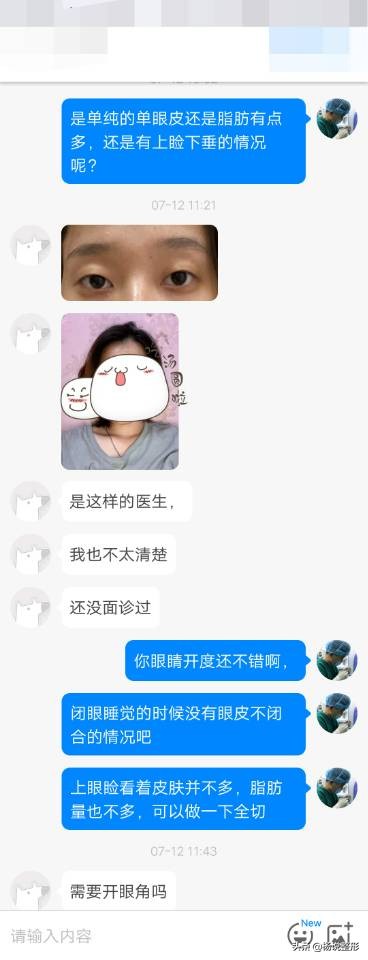 割双眼皮一定好看吗,割双眼皮真的好看吗