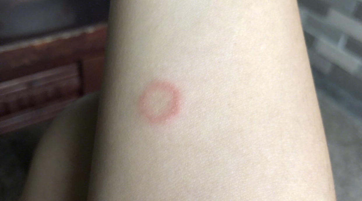 猫癣人和猫怎么处理,猫癣的猫碰过的东西怎么处理