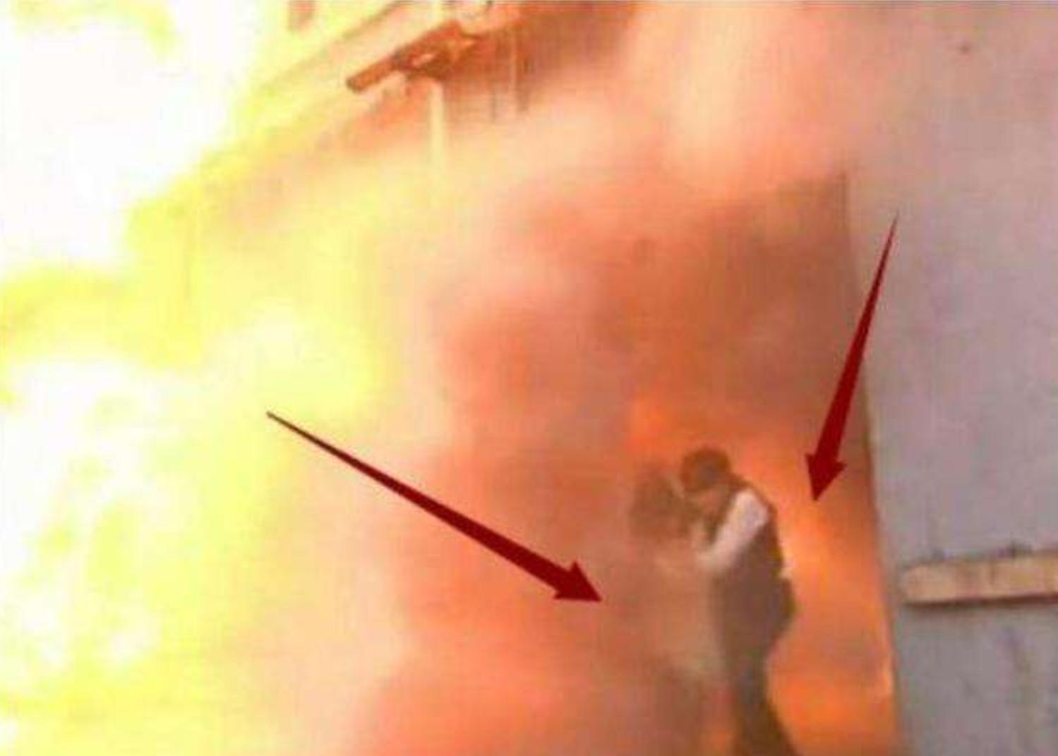 任家萱讲述烧伤经历,任家萱烧伤完整赔偿