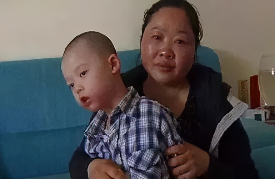 药监局点名！湿疹宝宝霜含禁用成分！这点做不好，再贵的药也没用