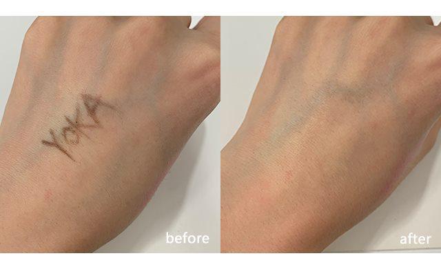 去屑还要注意这3点,控油去屑告别困扰