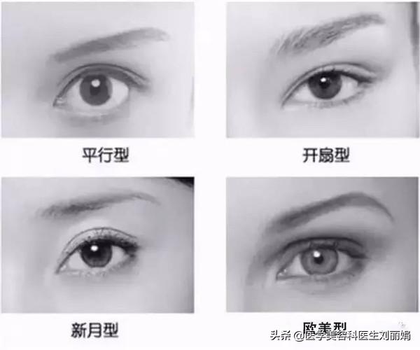 尚雯婕单眼皮吗,尚雯婕参加王牌视频