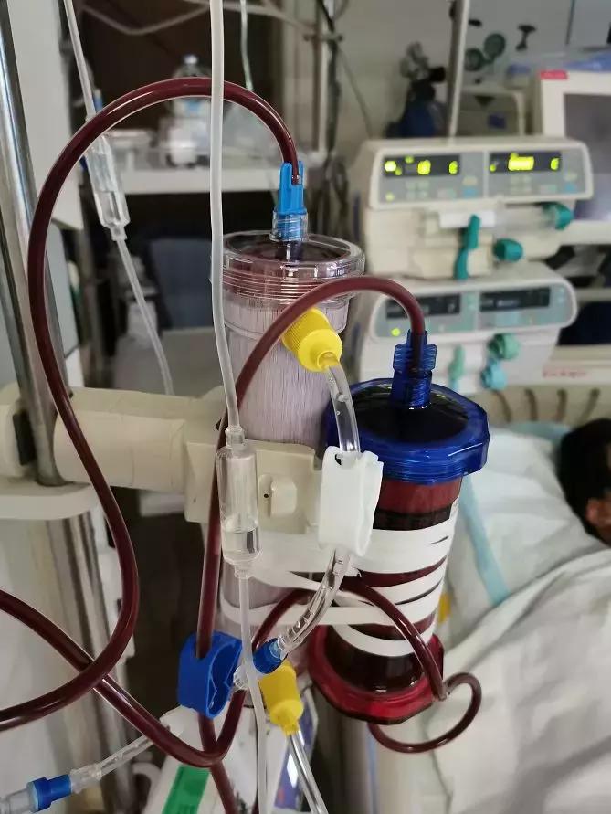 整吞河豚皮八旬老人险些丧命,生吞草鱼鱼胆