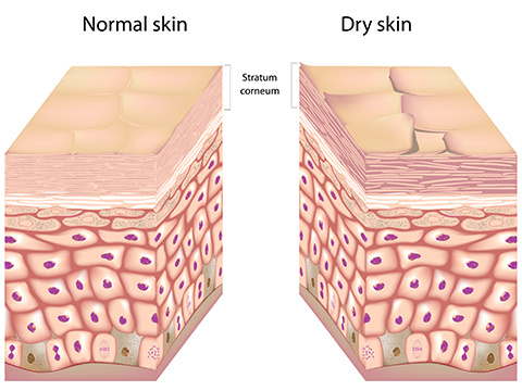 轻松搞定脸上的干纹细纹,脸上干纹细纹比较多怎么办