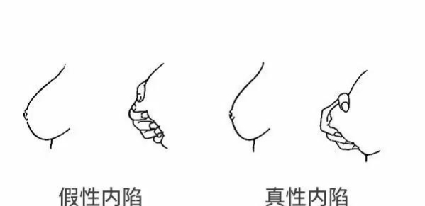 准妈妈生宝宝的问题有哪些,准妈妈生孩子的迹象