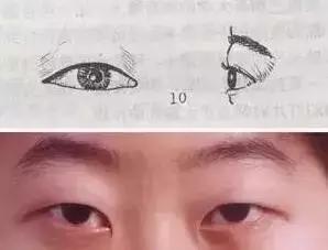 把水光针当饭吃？这位网红简直丧心病狂！整容后年入千万