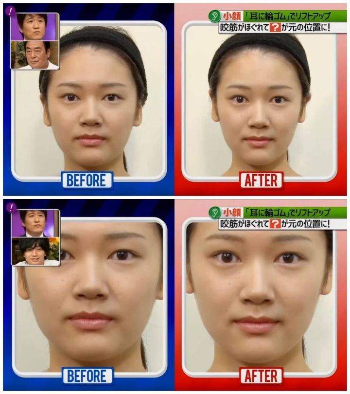 大方脸怎么靠微调改善脸型,改善脸型脸宽