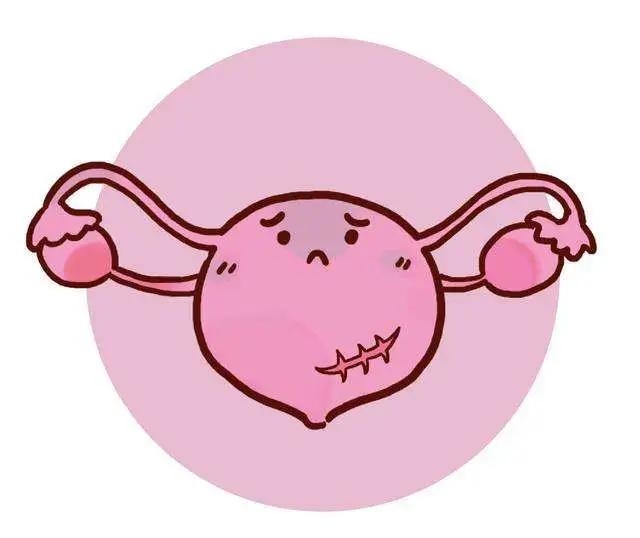 自然分娩和剖腹产的比较,自然分娩与剖宫产的比较与选择