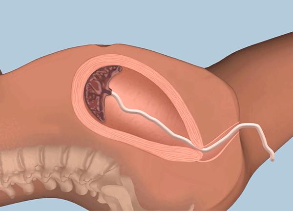 女人生孩子到底有多疼?