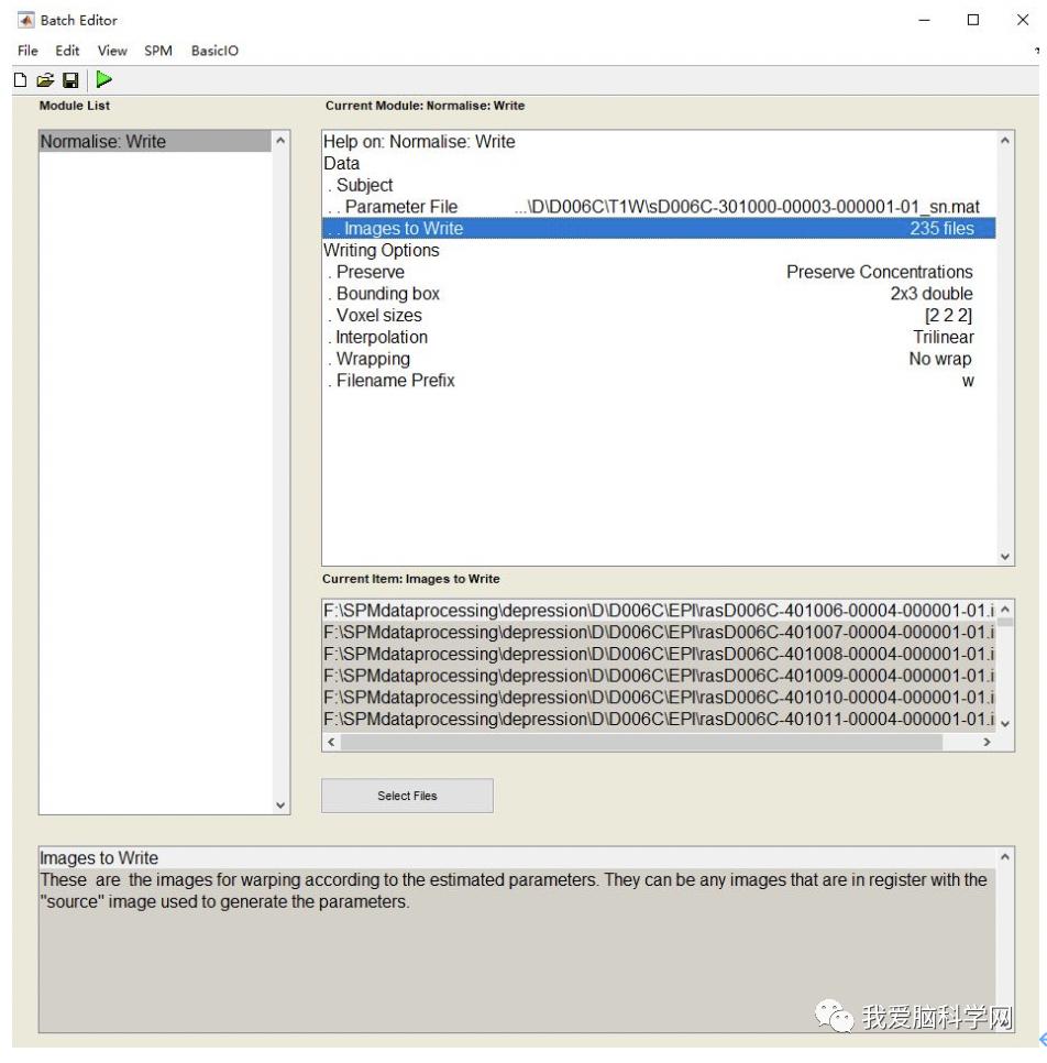 脑功能报告解读,颅脑mri信号讲解视频教程