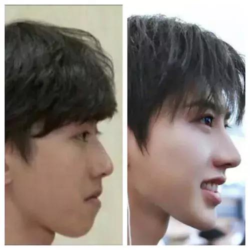 蔡徐坤身高成长史,蔡徐坤为什么相貌改变这么大