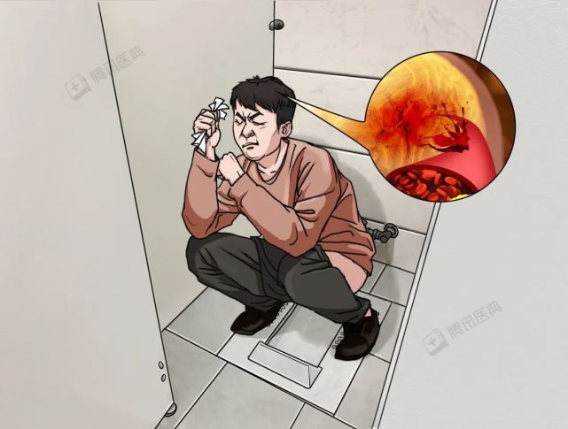 蹲便和坐便，到底谁更容易溅起细菌？