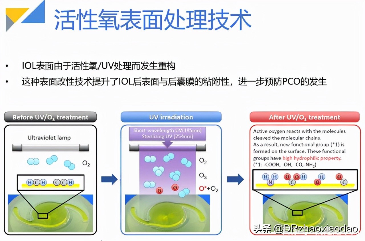 白内障手术人工晶体选择,白内障手术人工晶体是怎么做的