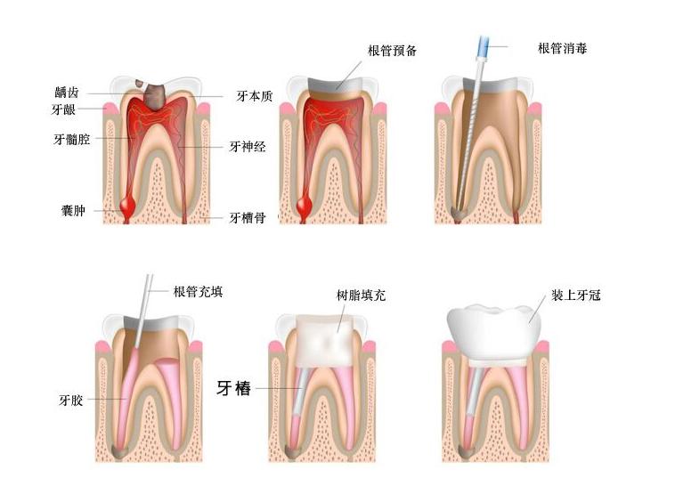口臭时隐时现，刷牙漱口无作用，牙医教你几个小妙招轻松去口臭