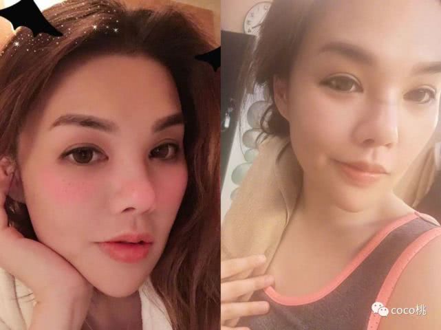 豪门千金赴韩整容香消玉殒，老公一口气要了上亿赔款？