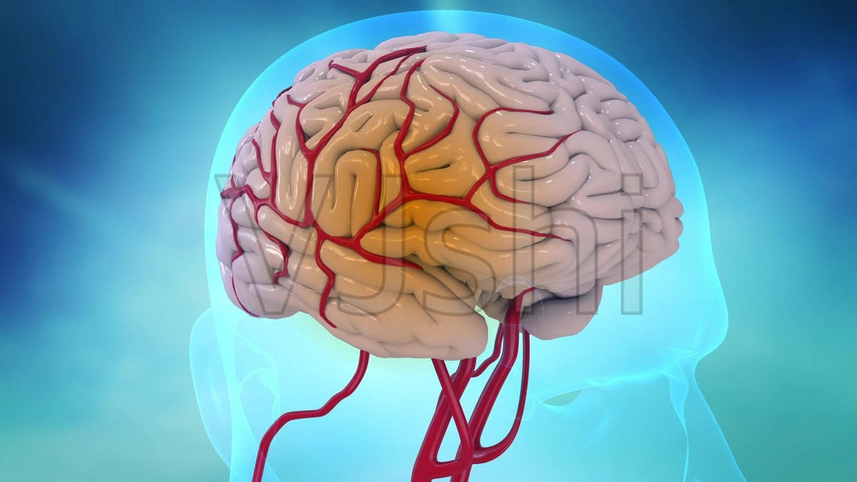 一旦脑梗发生还能治愈吗,一旦得了脑梗就要终身服药