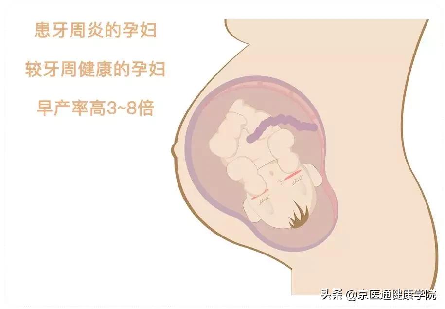 牙周炎会诱发心脏病、消化疾病、糖尿病、癌症？必须警惕牙齿健康