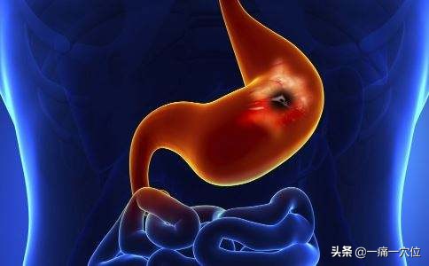 胃病的“对应穴”，尤其第3穴，每天揉一揉胃痛胃酸悄悄消失！