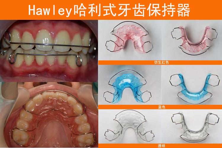 牙齿矫正完后不戴保持器会怎么样,牙齿矫正后不戴保持器会怎么样