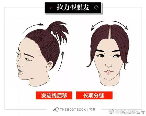 还在担心假发片翻车？复活发际线仅需几招，韩美娟直呼后悔才看到