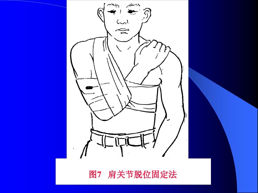 摔倒的肩膀脱位最佳治疗方法,摔了一跤肩袖损伤怎么办